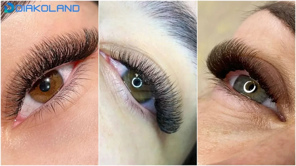 کاشت مژه اسپایکی نچرال