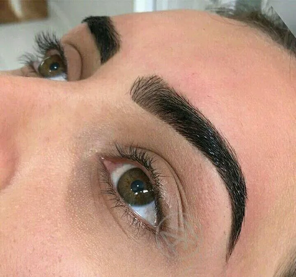 Eyebrow hairline 1