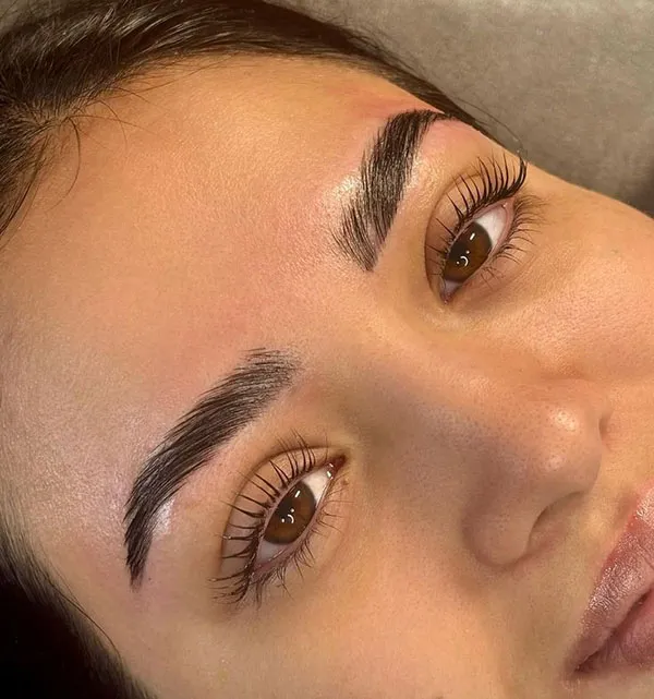 Eyebrow hairline 13