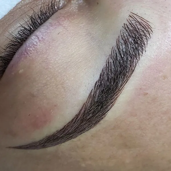 Eyebrow hairline 15