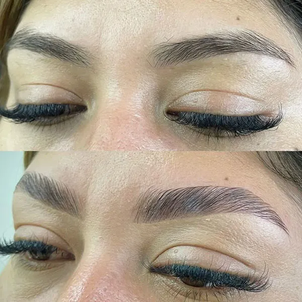 Eyebrow hairline 17