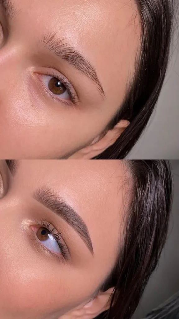 Eyebrow hairline 23