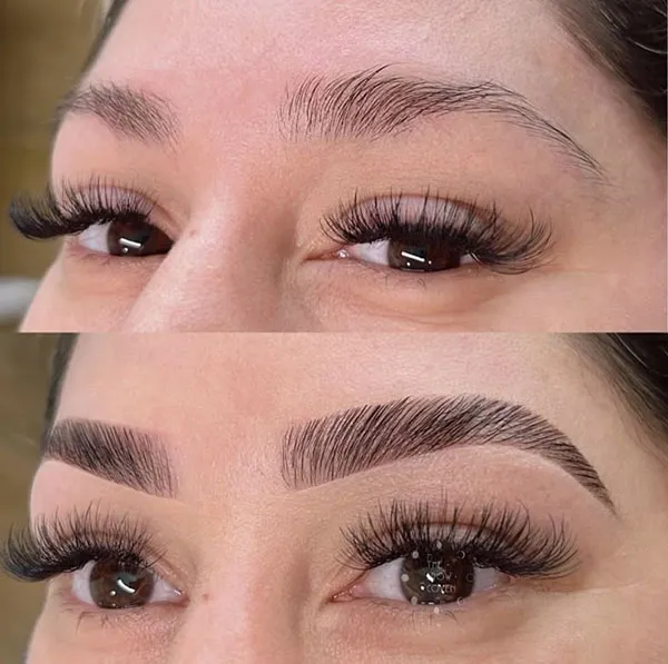 Eyebrow hairline 32