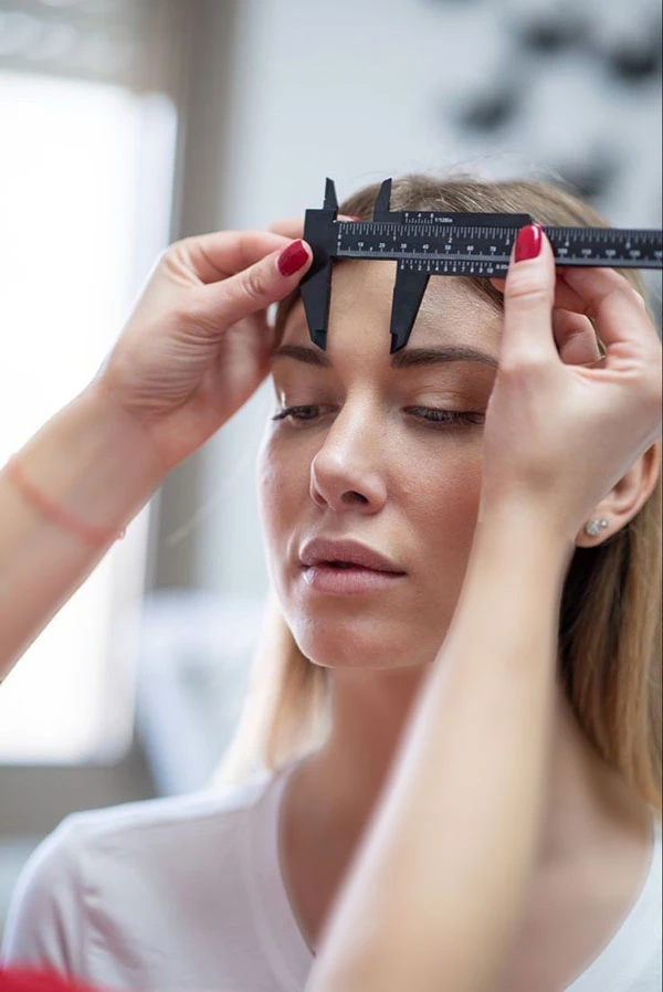 چند روز بعد از کاشت ابرو میریزد؟ | همه چیز درباره ریزش بعد از کاشت تا 12 ماه 5 Hair loss after eyebrow transplantation 1