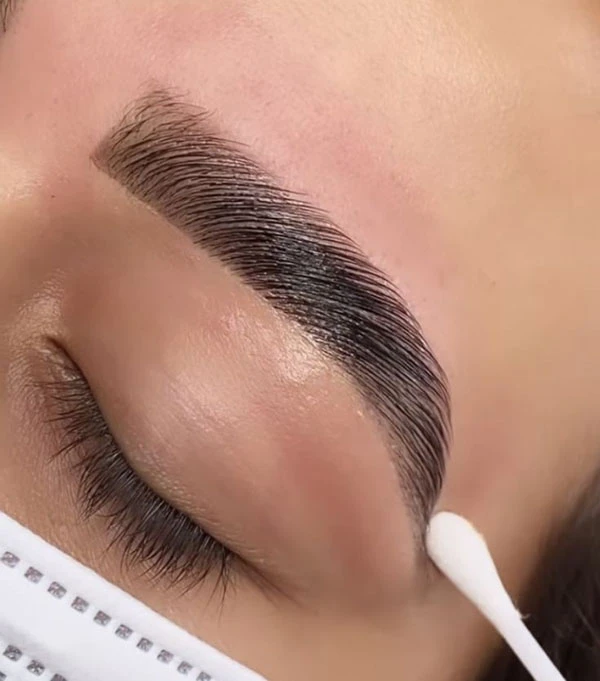چند روز بعد از کاشت ابرو میریزد؟ | همه چیز درباره ریزش بعد از کاشت تا 12 ماه 10 Hair loss after eyebrow transplantation 6