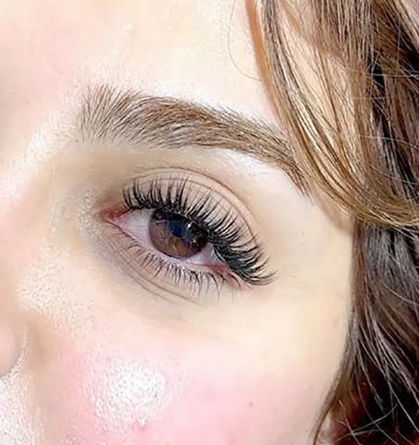 Natural Tespiki Eyelash Transplant 4