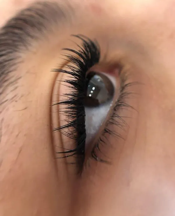 Natural Tespiki Eyelash Transplant 7