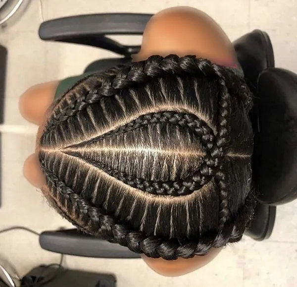 Texture of the scalp 11