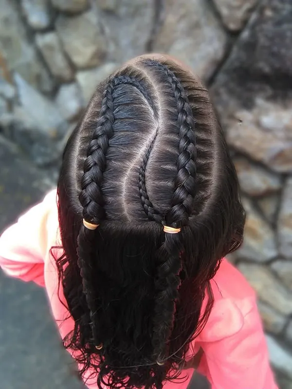 Texture of the scalp 21