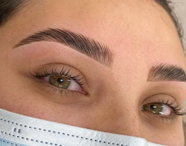 Thin eyebrow lift 1