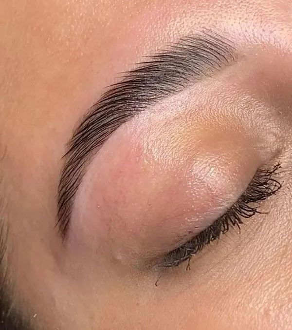 Thin eyebrow lift 14