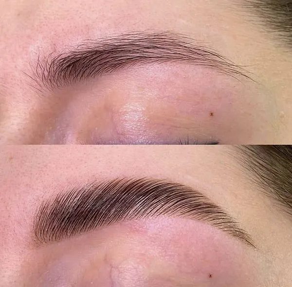 Thin eyebrow lift 5