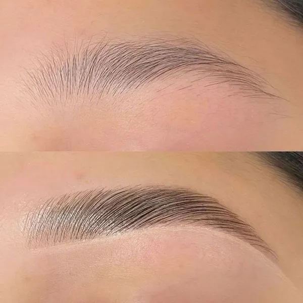 Thin eyebrow lift 7