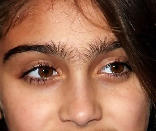 Continuous eyebrow model 11