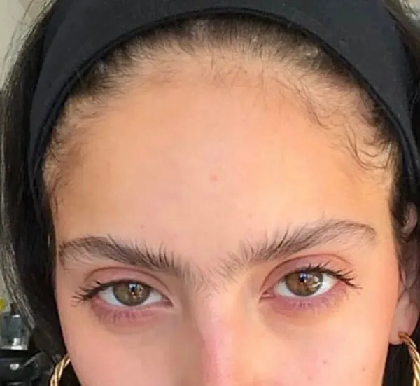 Continuous eyebrow model 31