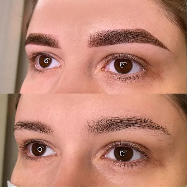 Photo of eyebrow 29