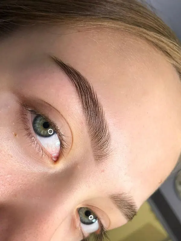 Natural eyebrow transplant model 12