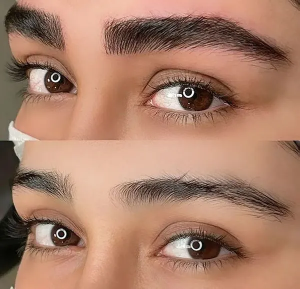 Natural eyebrow transplant model 15