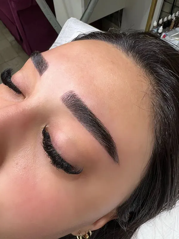 Natural eyebrow transplant model 2