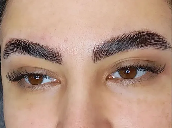 Natural eyebrow transplant model 27