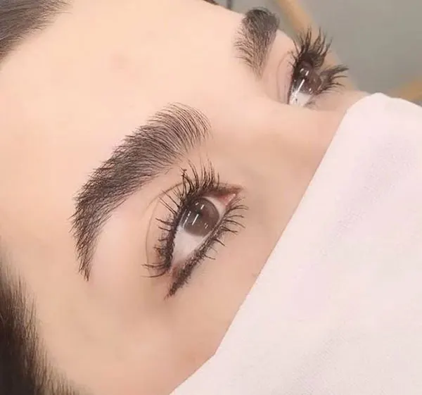 Natural eyebrow transplant model 3