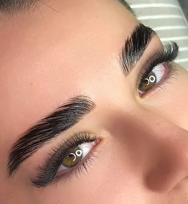 Natural eyebrow transplant model 5