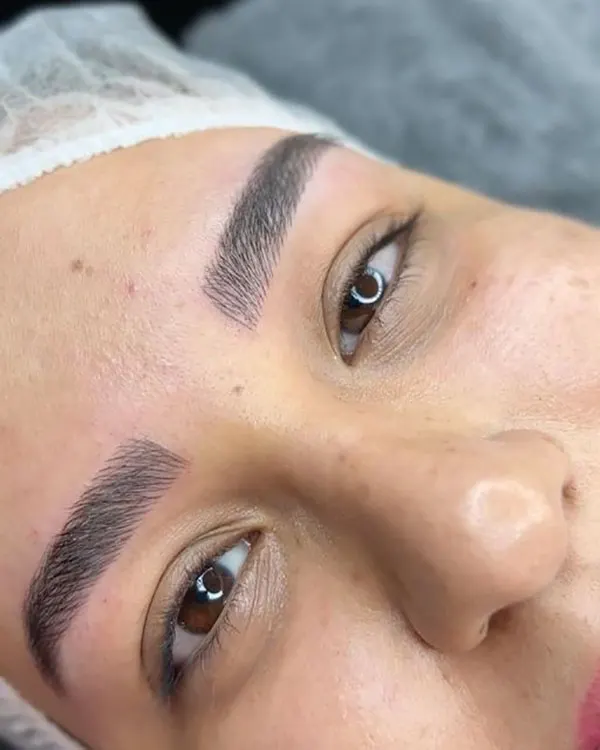 Natural eyebrow transplant model 8