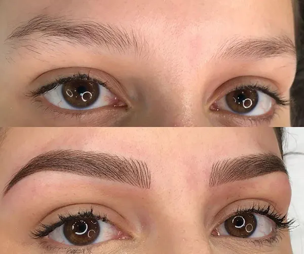 Girls eyebrow fibrosis model 10