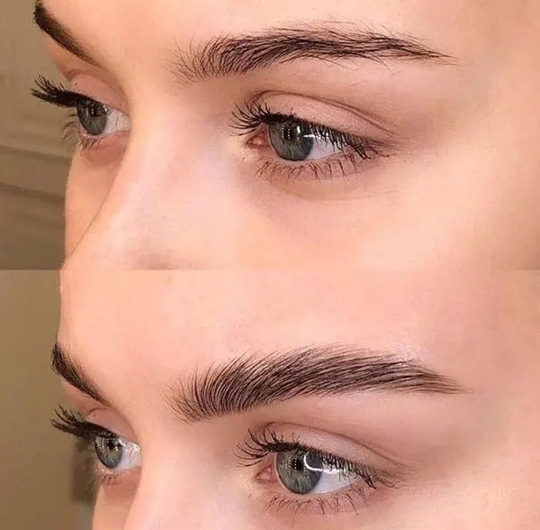 Girls eyebrow fibrosis model 12