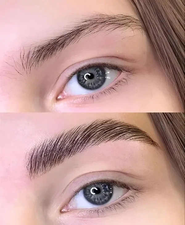 Girls eyebrow fibrosis model 16