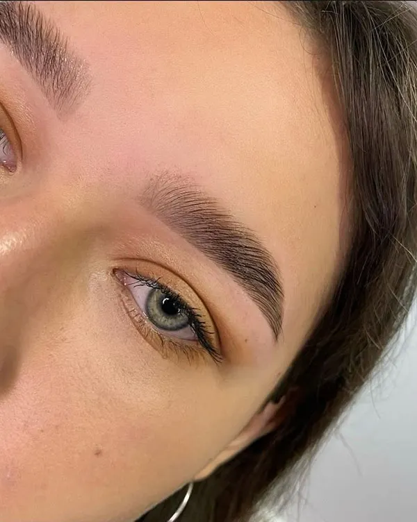 Girls eyebrow fibrosis model 2