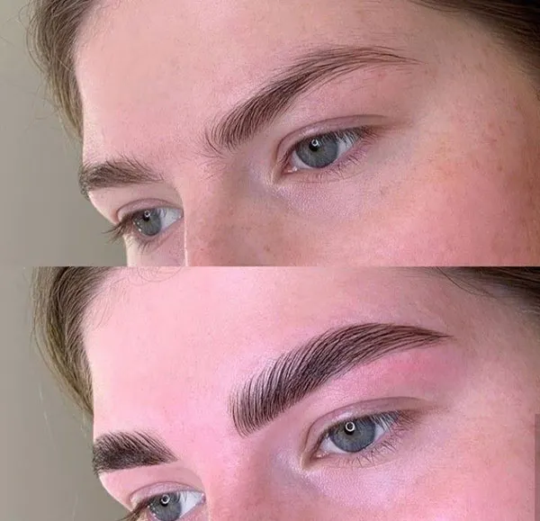 Girls eyebrow fibrosis model 6
