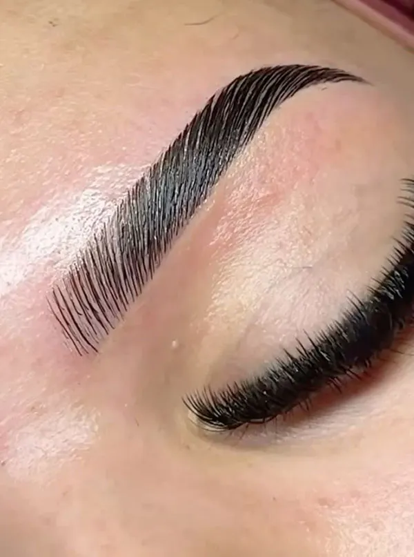 Eyebrow lift with thread 10