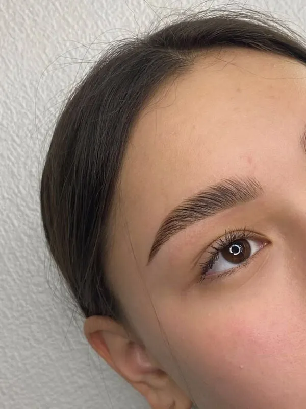 Eyebrow lift with thread 11
