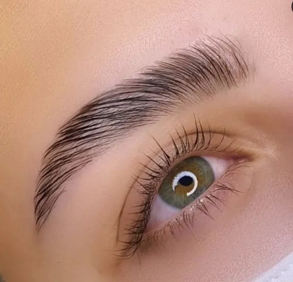 Eyebrow lift with thread 12