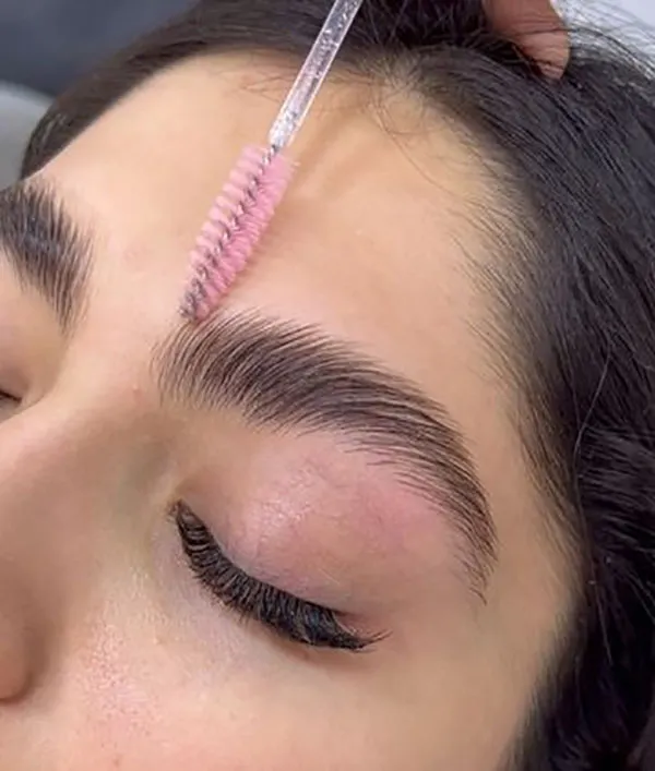 Eyebrow lift with thread 17