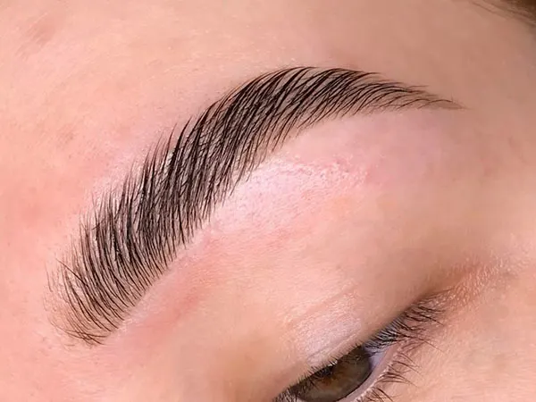 Eyebrow lift with thread 18