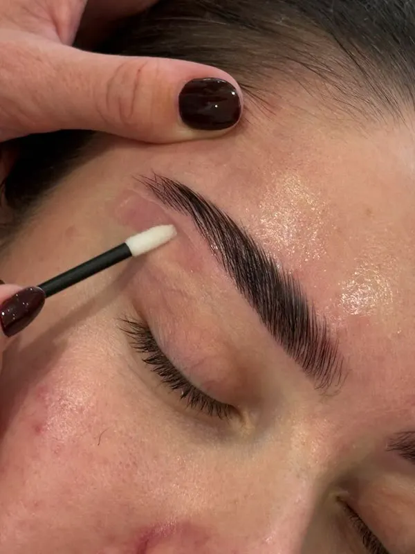 Eyebrow lift with thread 19