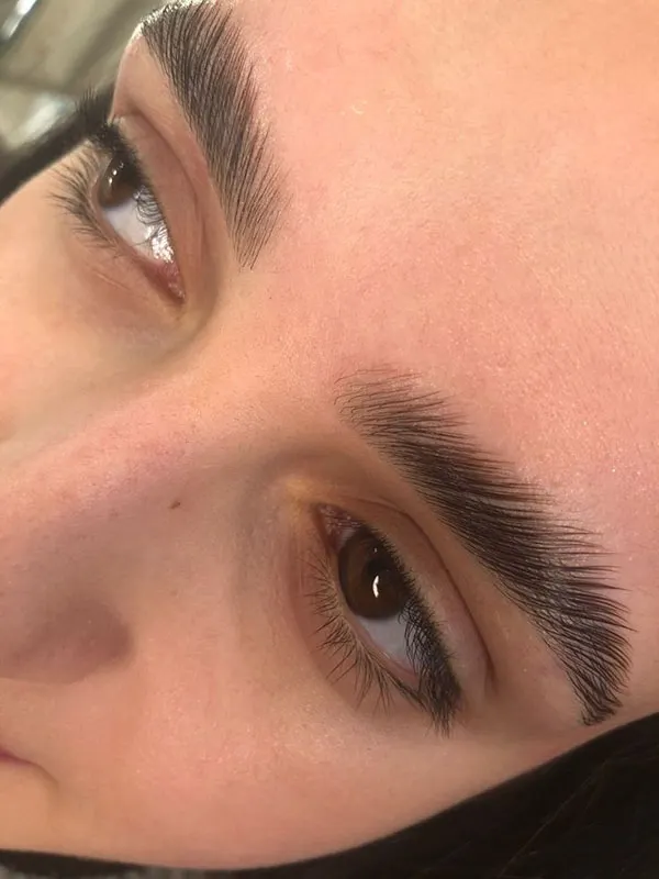Eyebrow lift with thread 2