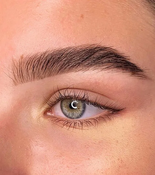Eyebrow lift with thread 21