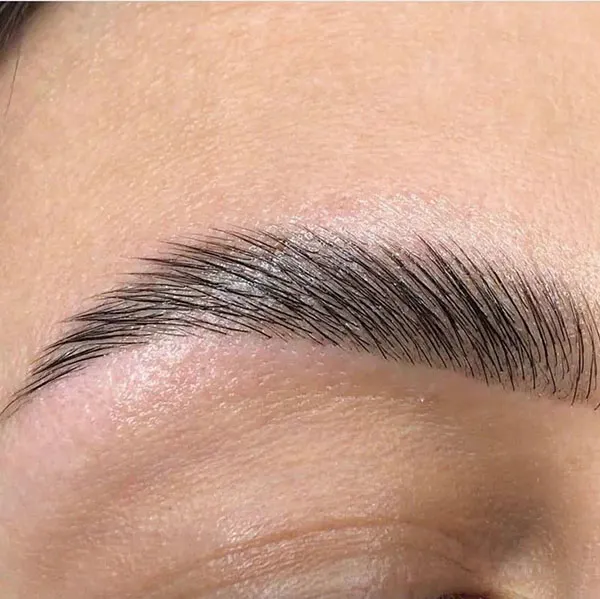 Eyebrow lift with thread 22