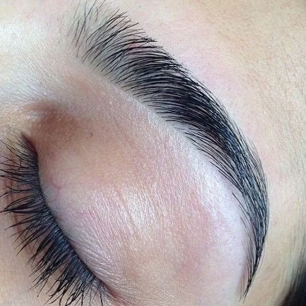 Eyebrow lift with thread 23