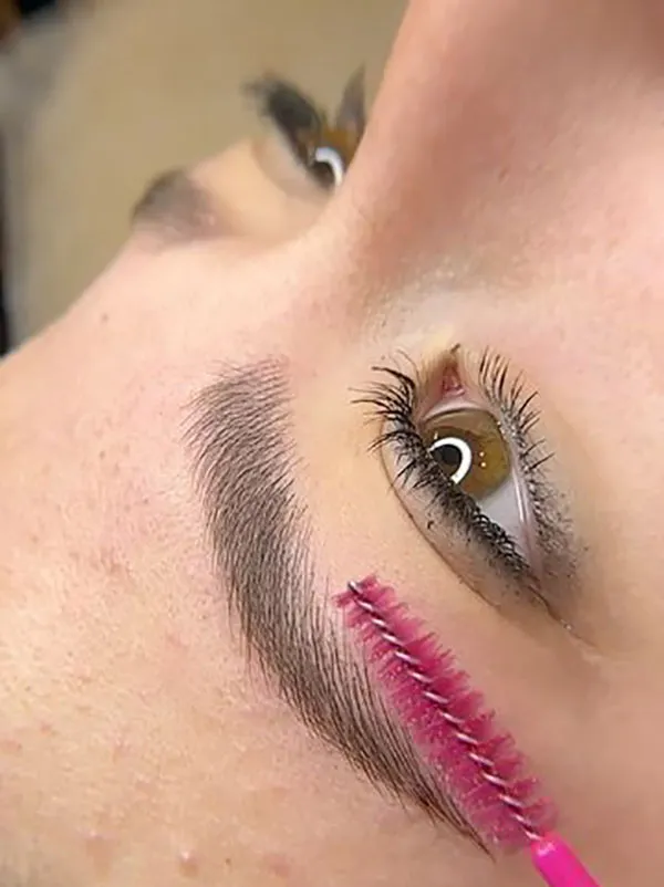 Eyebrow lift with thread 25