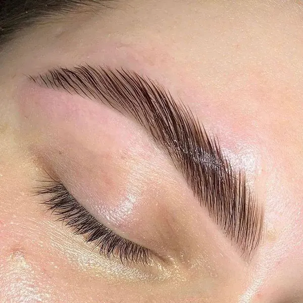 Eyebrow lift with thread 27