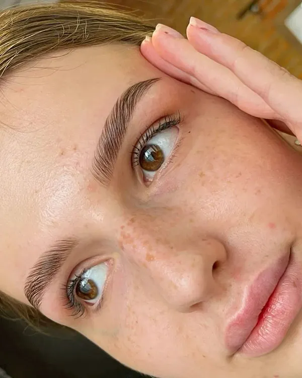 Eyebrow lift with thread 28