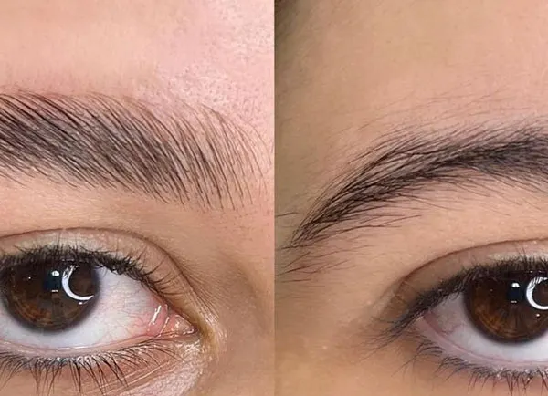 Eyebrow lift with thread 29