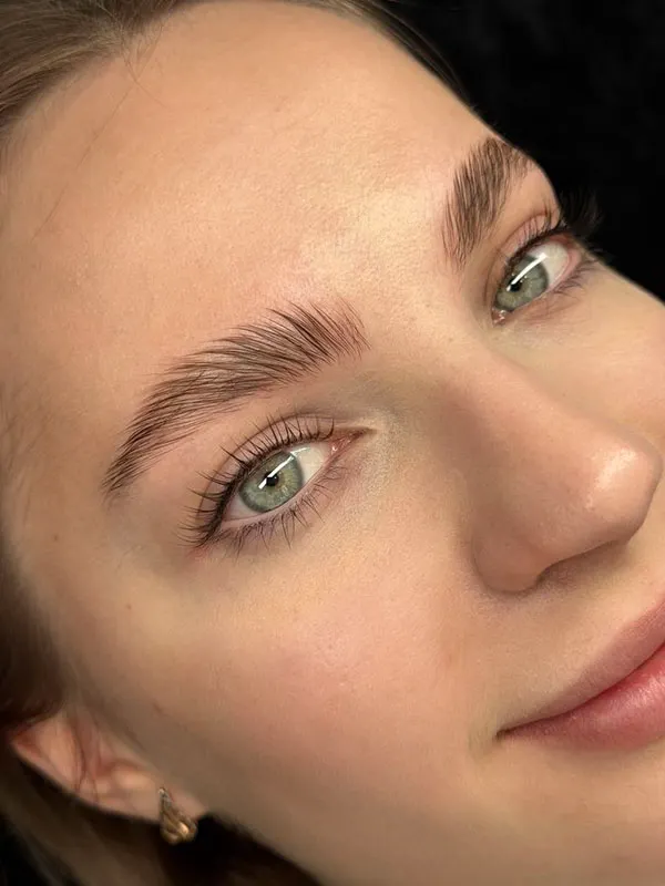 Eyebrow lift with thread 30
