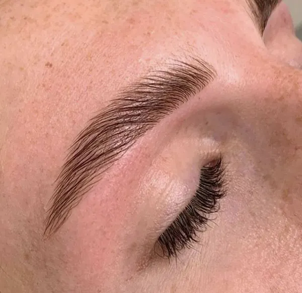 Eyebrow lift with thread 4