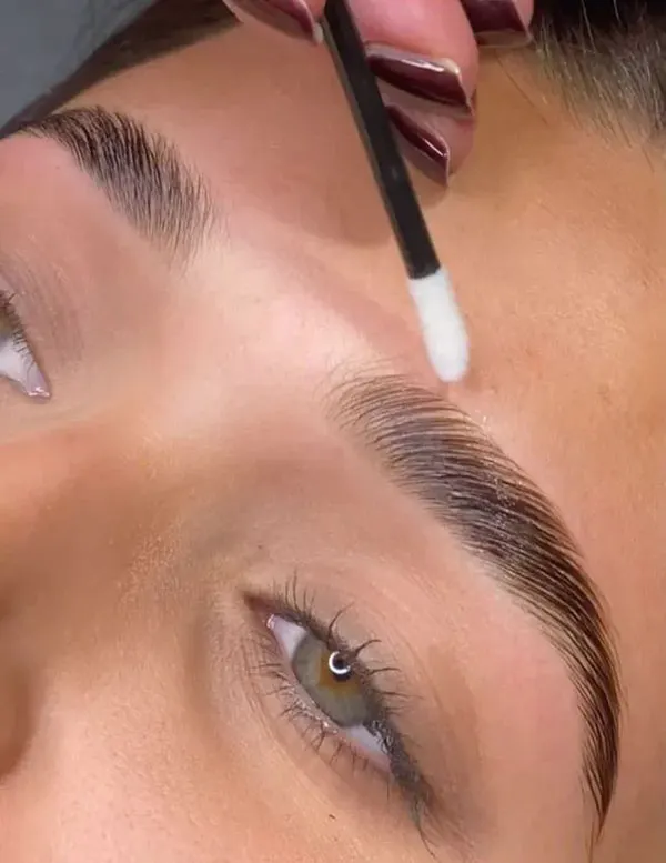 Eyebrow lift with thread 6