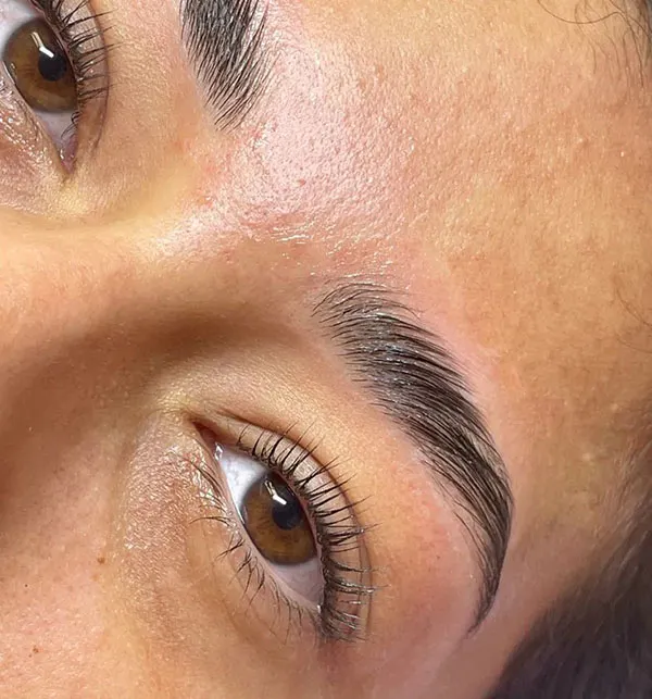 Eyebrow lift with thread 7